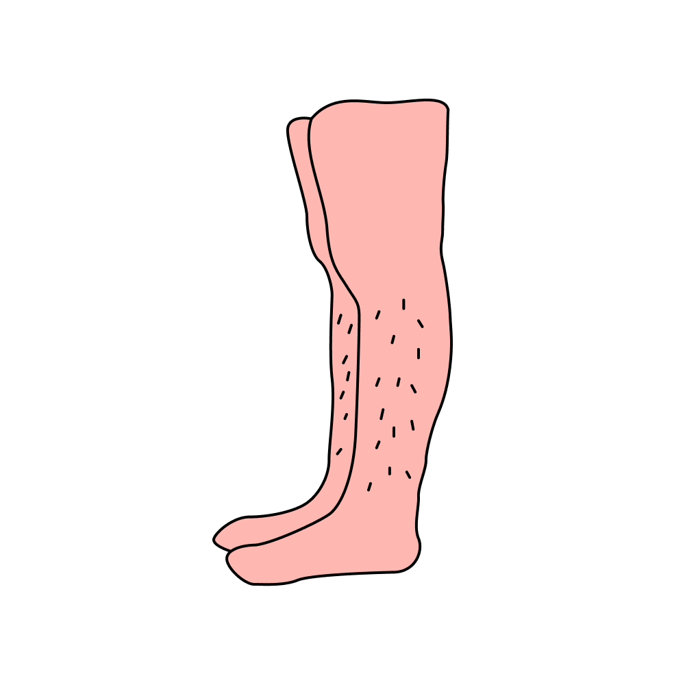 Odd Human Legs_filled